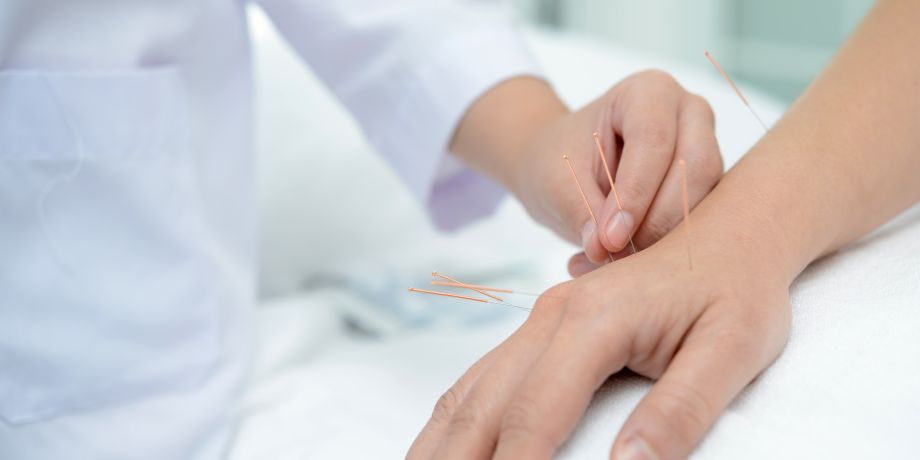 Akupunktur