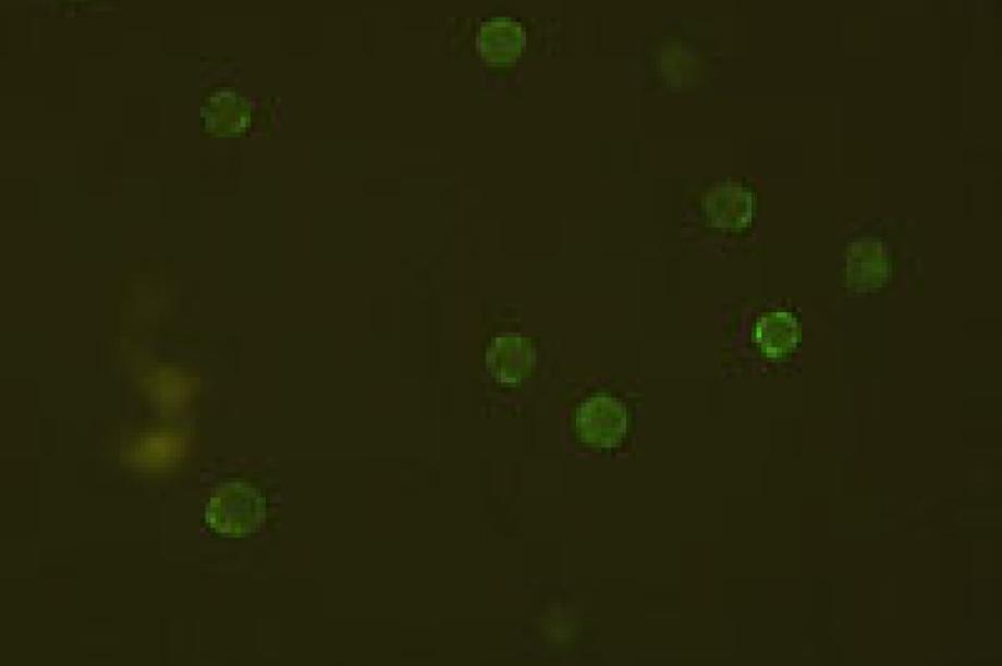 Granulozytenimmunfluoreszenztest stark positiv