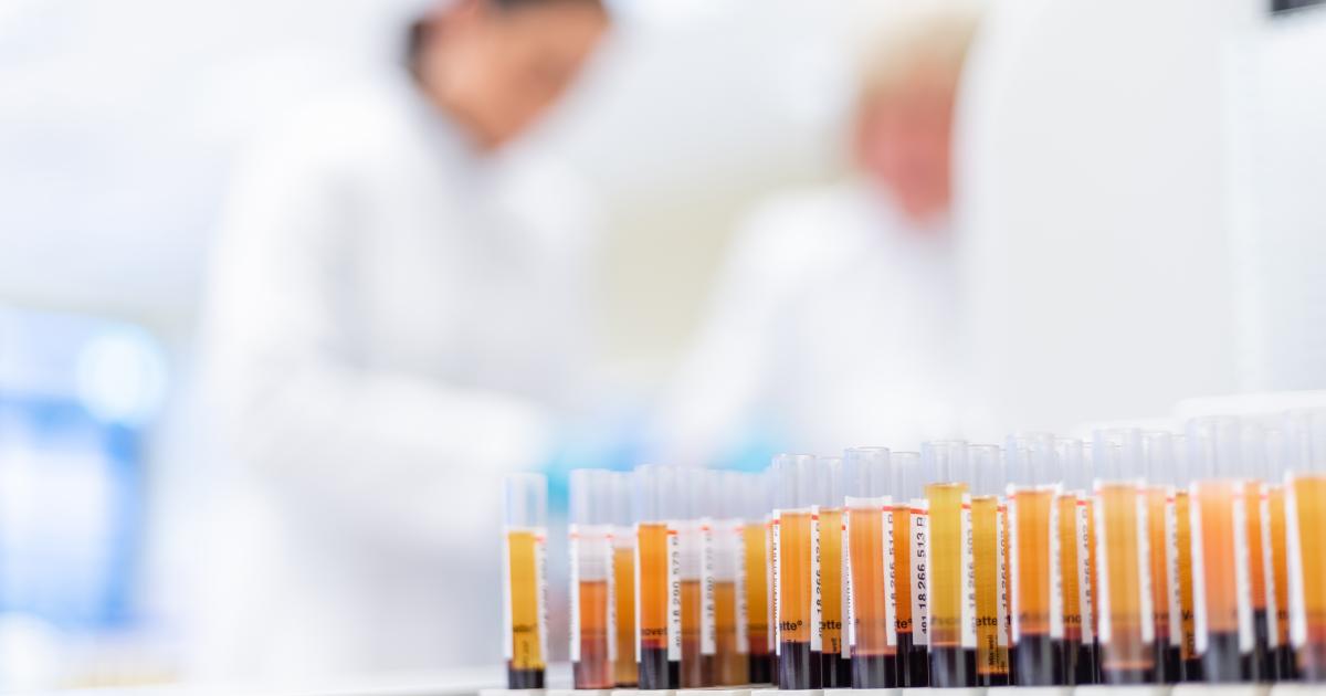 Woraus Besteht Blut Eigentlich Drk Blutspendedienst West